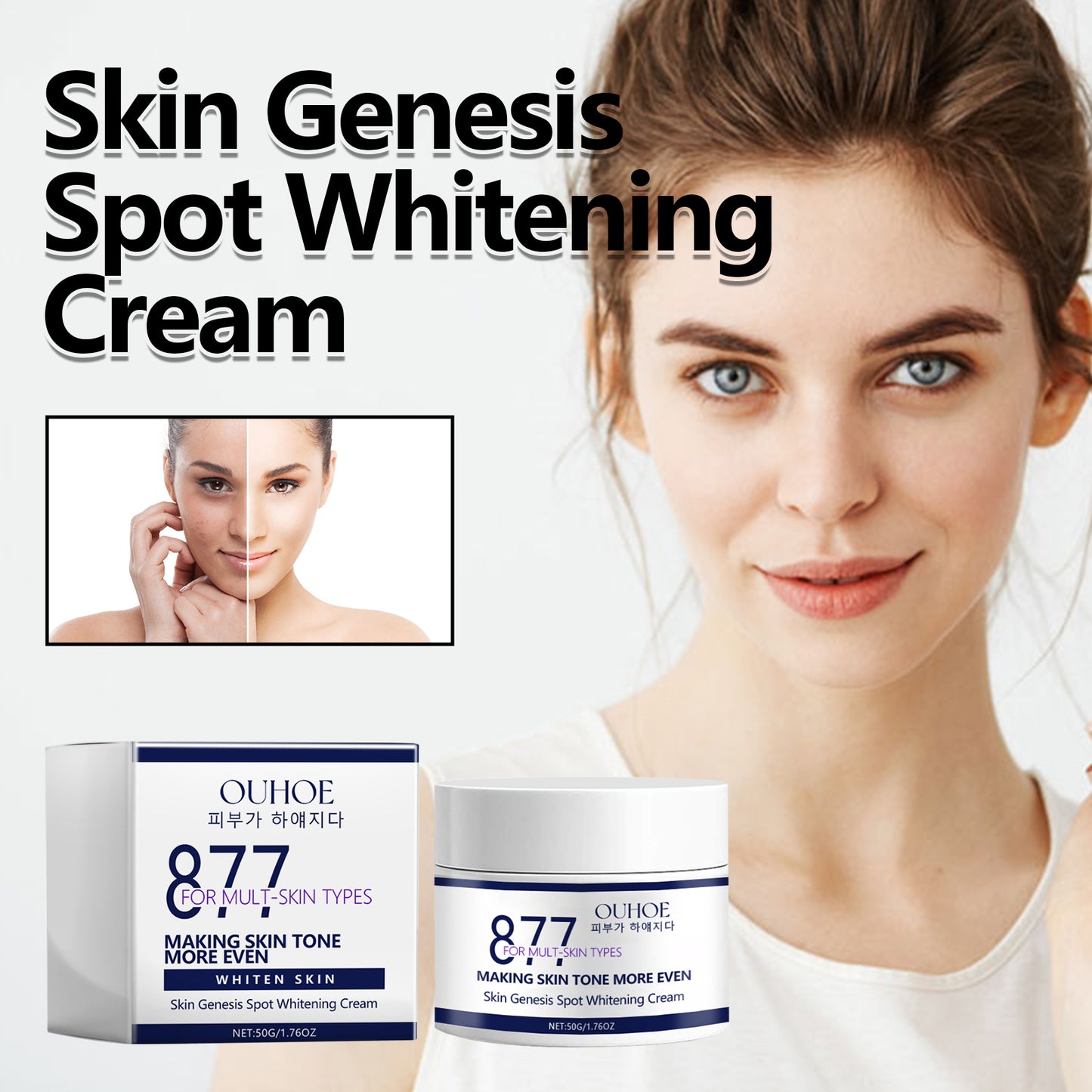 Skin Genesis Spot Whitening Cream, Moisturizing and rejuvenating Skin Whitening body Skin care cream