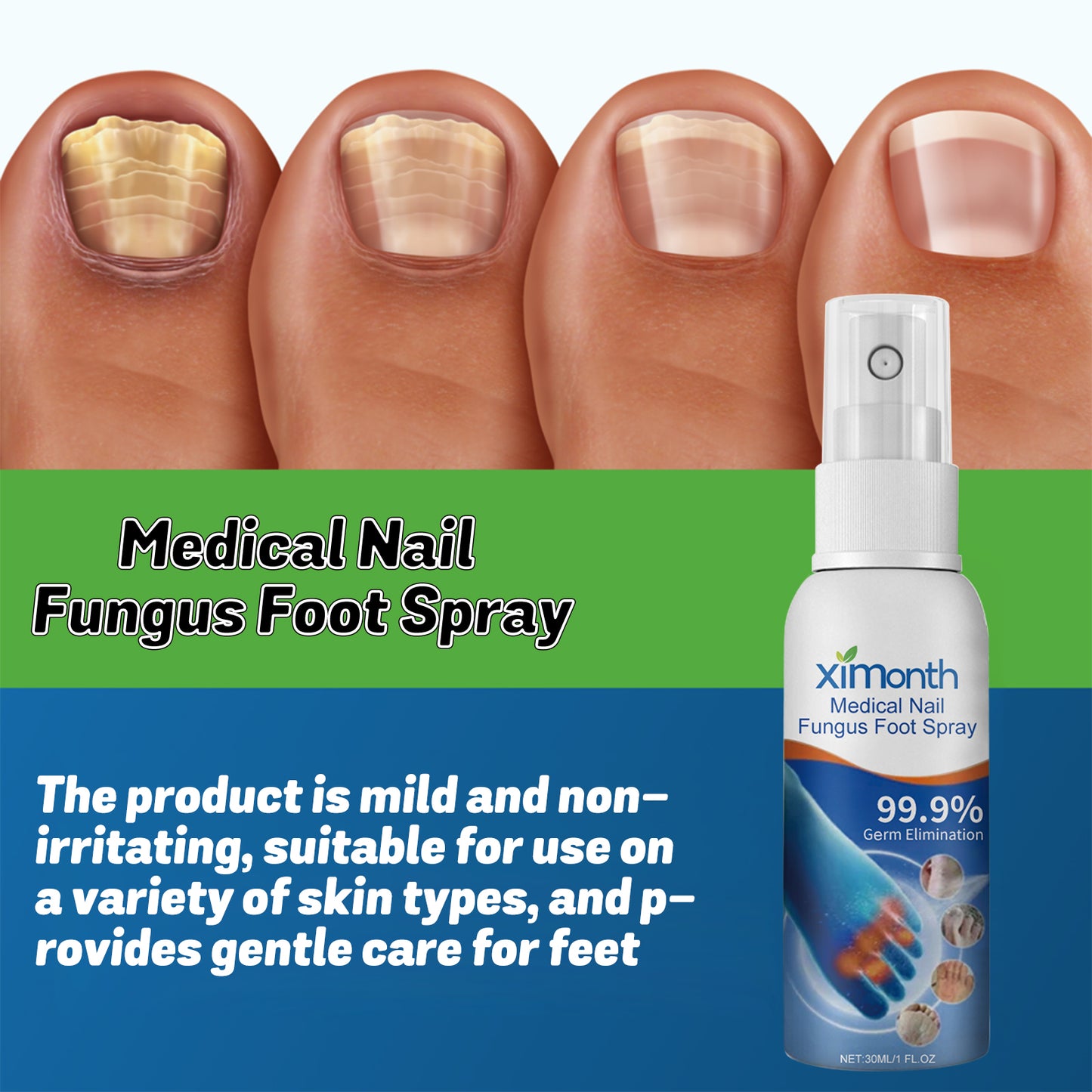 Medical Nail Fungus Foot Spray, Repair Thickening Gray Nail Rot Foot Moisturizing And Cleansing Armor