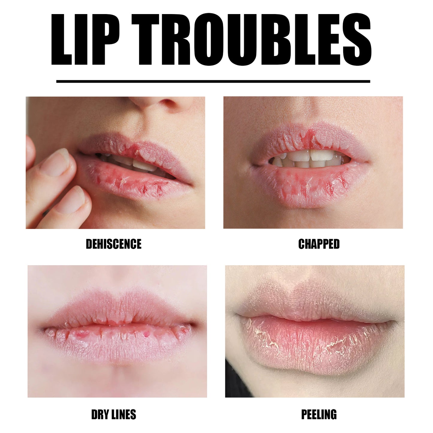 Lip Scrub, Lip Wrinkles Dry Dead Skin Moisturizing Toot Lips Moist Lips Lip Care