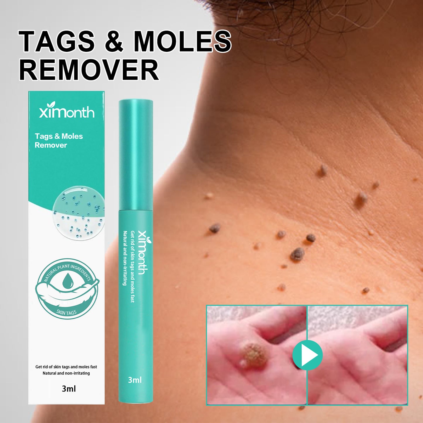 Keyu Liquid Repair Smooth Face Body Skin Deep Cleaning Moles Corns Keyu Liquid Pen