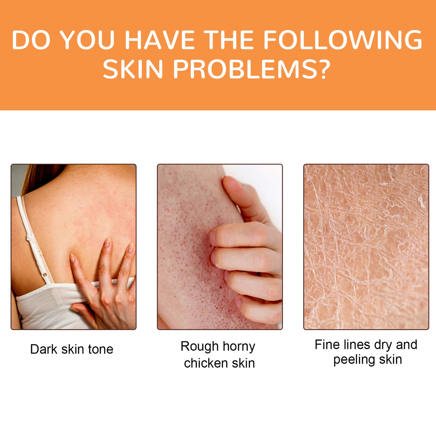 Vitamin C Brightening Body Oil, Hydrating Repair Chicken Skin Brightening Body Care Oil