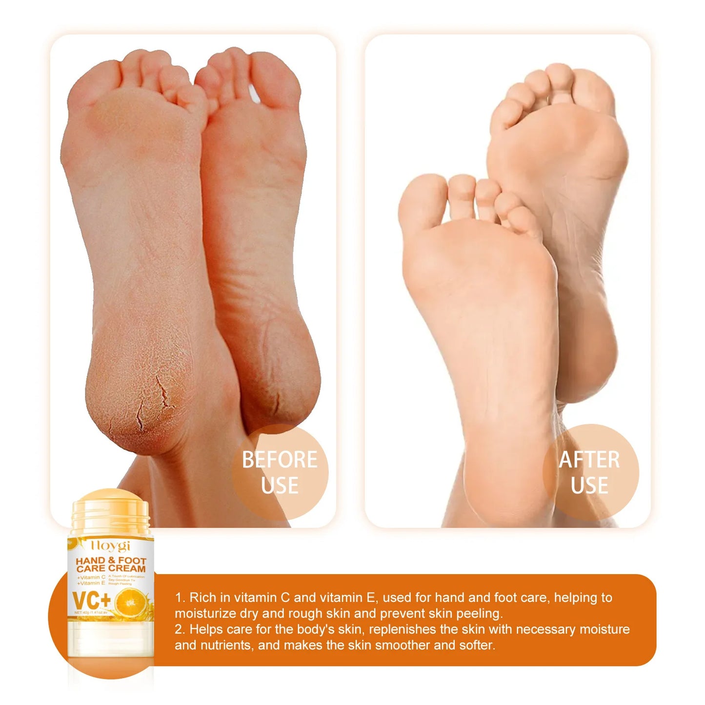 Anti Crack Foot Cream Remove Dead Skin Calluse Drying Repair Heel Chapping Smooth Nourishing Exfoliating Moisturizer Foot Cream