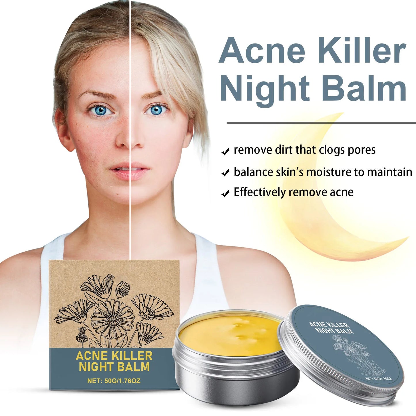 Acne Cream,remove Dirt That Clogs Pores,balance Skin's Moisture To Maintain,Effectively Remove Acne On Facial Skin,50g