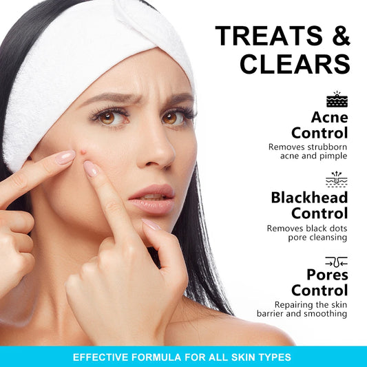 AUQUEST Salicylic Acid Acne Cream – Oil Control, Pore Care, Niacinamide, 15ml