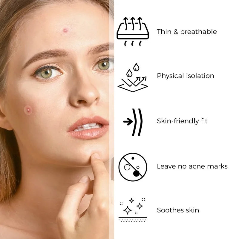 Acne Patch Pimple Cover Repair Facial Acne Treatment Smooth Skin Care Non-Irritating Mild Acne Pimple Patch