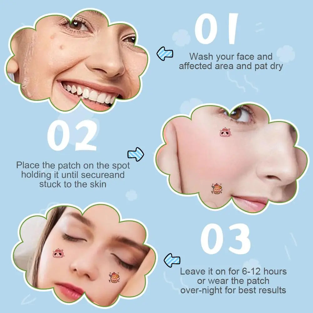 96 pcsCartoon Acne Patches Cartoon Cat Shaped Acne Treatment Sticker Invisible Acne Cover Removal Pimple Patch Skin Care
