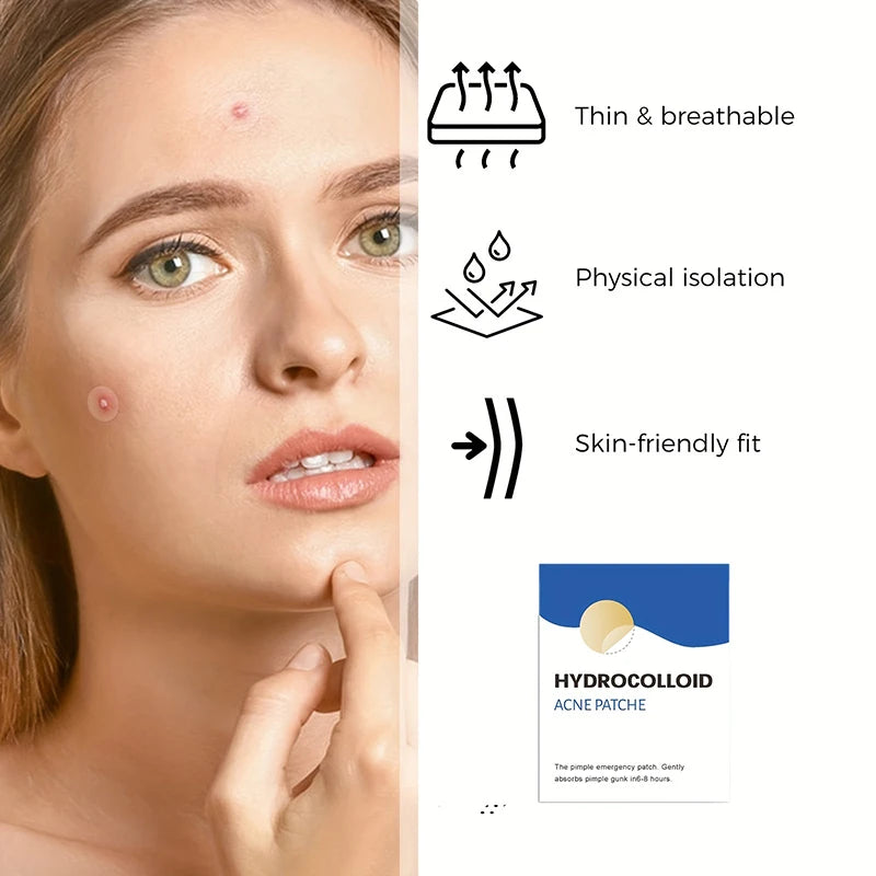 Cute Pimple Patches | Invisible Acne Cover Stickers for Face – Spot Dots for Beauty & Skincare