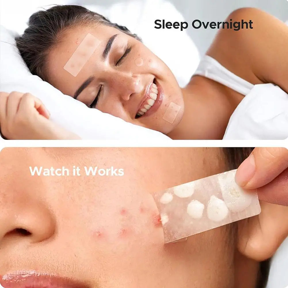 Acne Care Patch Anti-inflammatory Healing Absorbing Spot Sticker Covering Acne Skin Care Stickers Multiple Shapes Pimple Patch