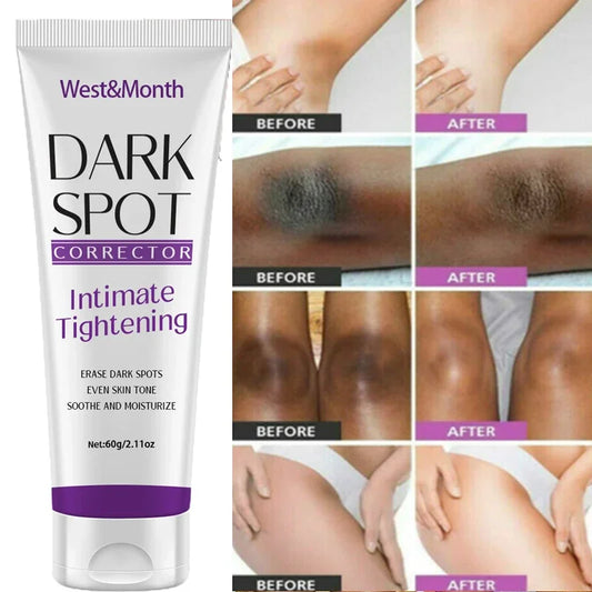 Nicotinamide Brightening Cream For Dark Skin Effective Lighten Thigh Inner Bleach Remove Melanin Private Parts Brighten CreamNEW