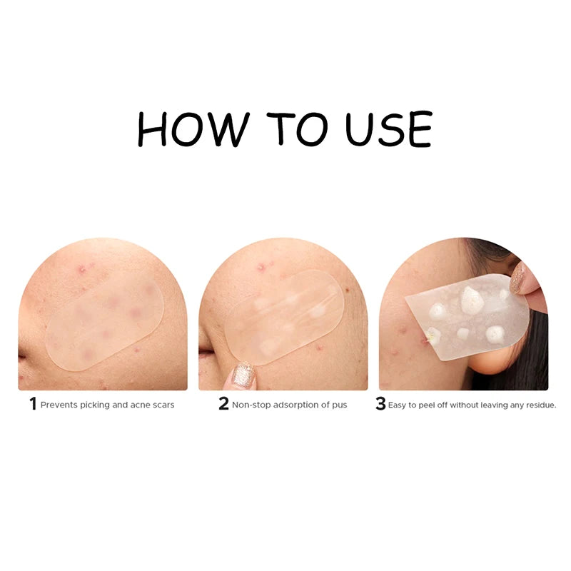 Large Capacity Acne Patch Hydrocolloid Salicylic Transparent Acne Patch Invisible Acne Removal Skin Care Stickers Face Beauty