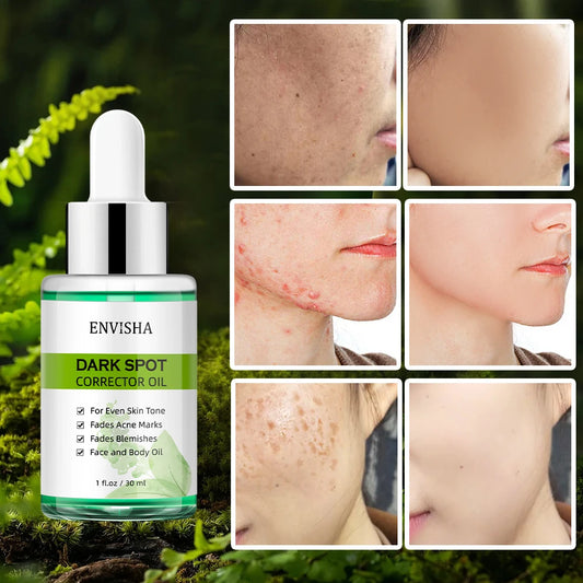 ENVISHA Face Skin Care Whitening Freckle Essential Oil Serum Remove Melasma Dark Spots Melanin Brighten Anti-Aging Shrink Pores