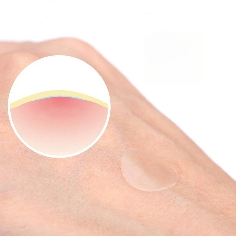 36 Patch Round Acne Patches Hydrocolloid Waterproof Pimple Removal Patches Invisible Acne Removal Patches Anti Acne Sticker