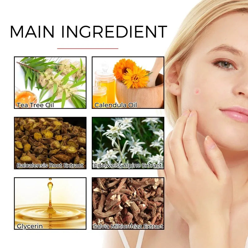 Acne Patch Pimple Cover Repair Facial Acne Treatment Smooth Skin Care Non-Irritating Mild Acne Pimple Patch