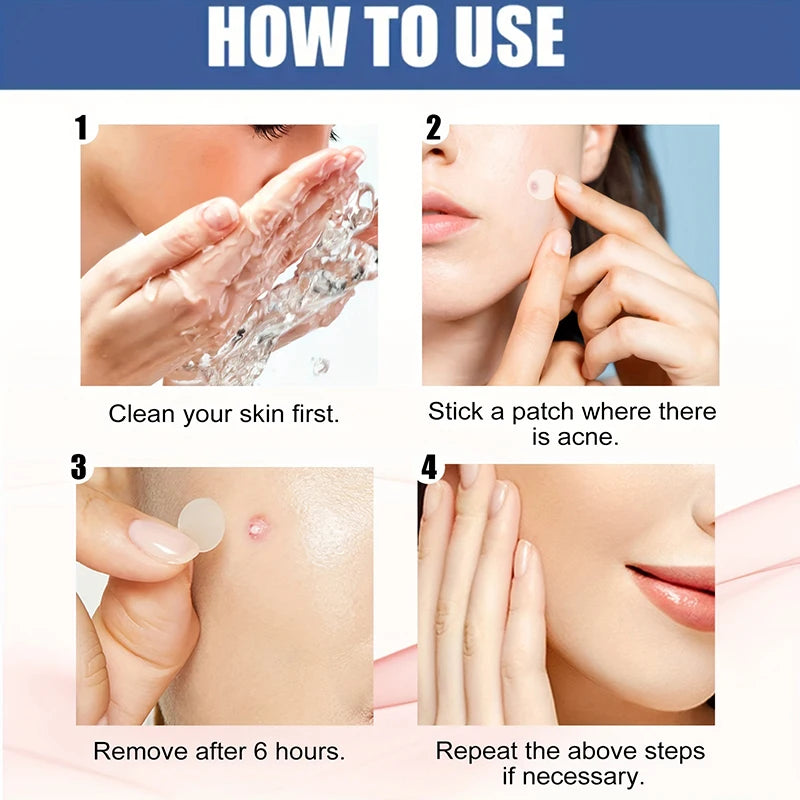 Cute Pimple Patches | Invisible Acne Cover Stickers for Face – Spot Dots for Beauty & Skincare