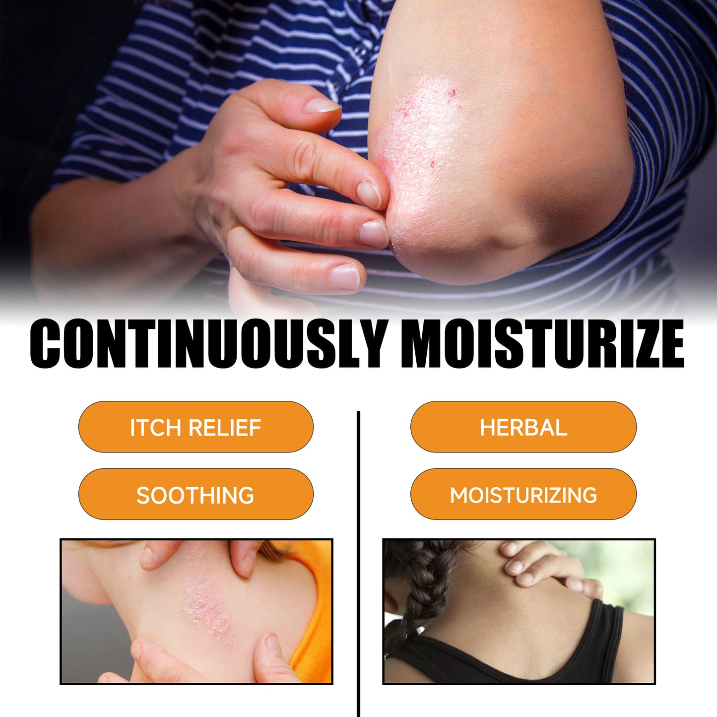Bee Venom Psoriasis Care Spray, Soothing Skin Irritation Repair Moisturizing And Tender Skin Care Spray