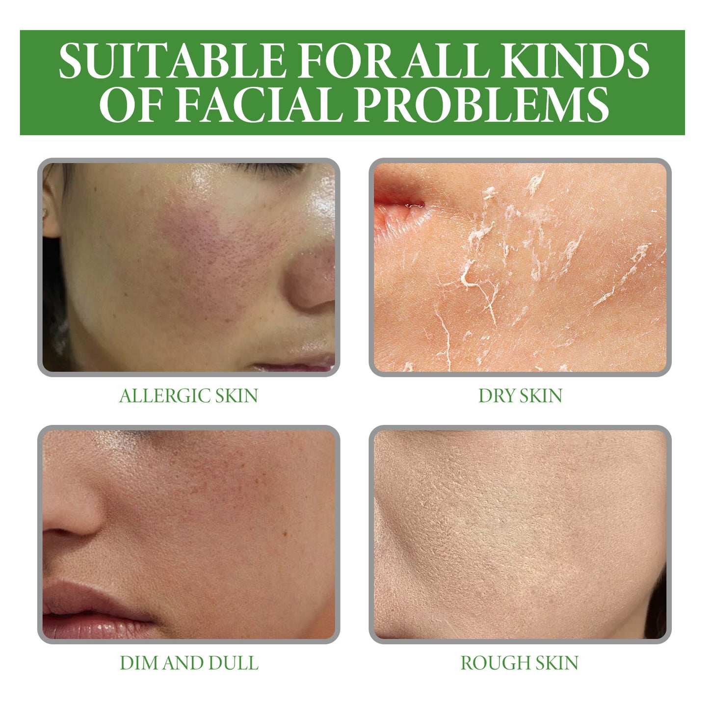Aloe Vera Serum, Repair Dry Skin Moisturizes And Hydrates To Lighten Pimples And Seal Delicate Pores