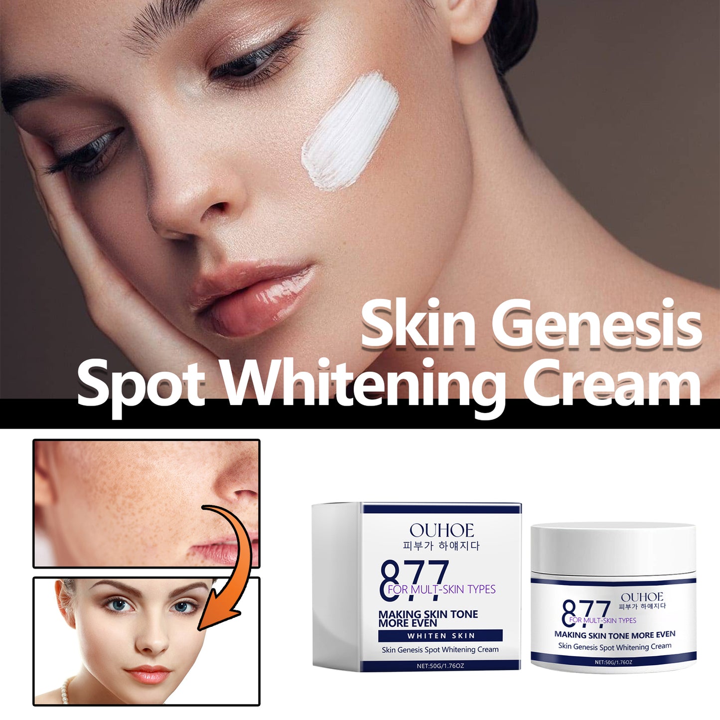 Skin Genesis Spot Whitening Cream, Moisturizing and rejuvenating Skin Whitening body Skin care cream