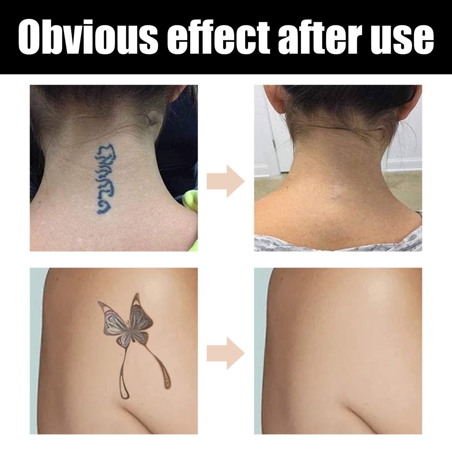 EELHOE Waterproof Tattoo & Scar Concealer | 2-Color High Coverage Cream for Tattoo, Birthmark & Skin Imperfections