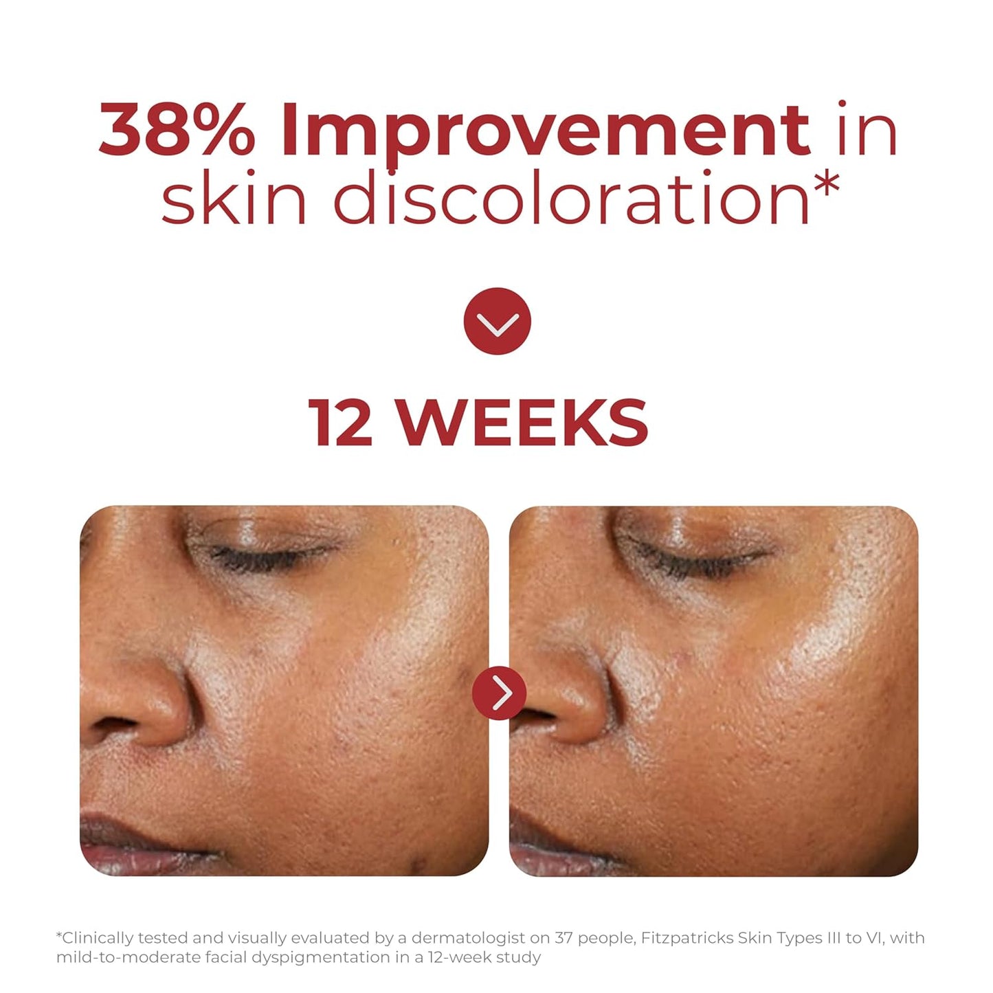 Eltamd UV Clear Tinted Face Sunscreen, SPF 46 Oil- Free with Zinc Oxide, Dermatologist Recommended
