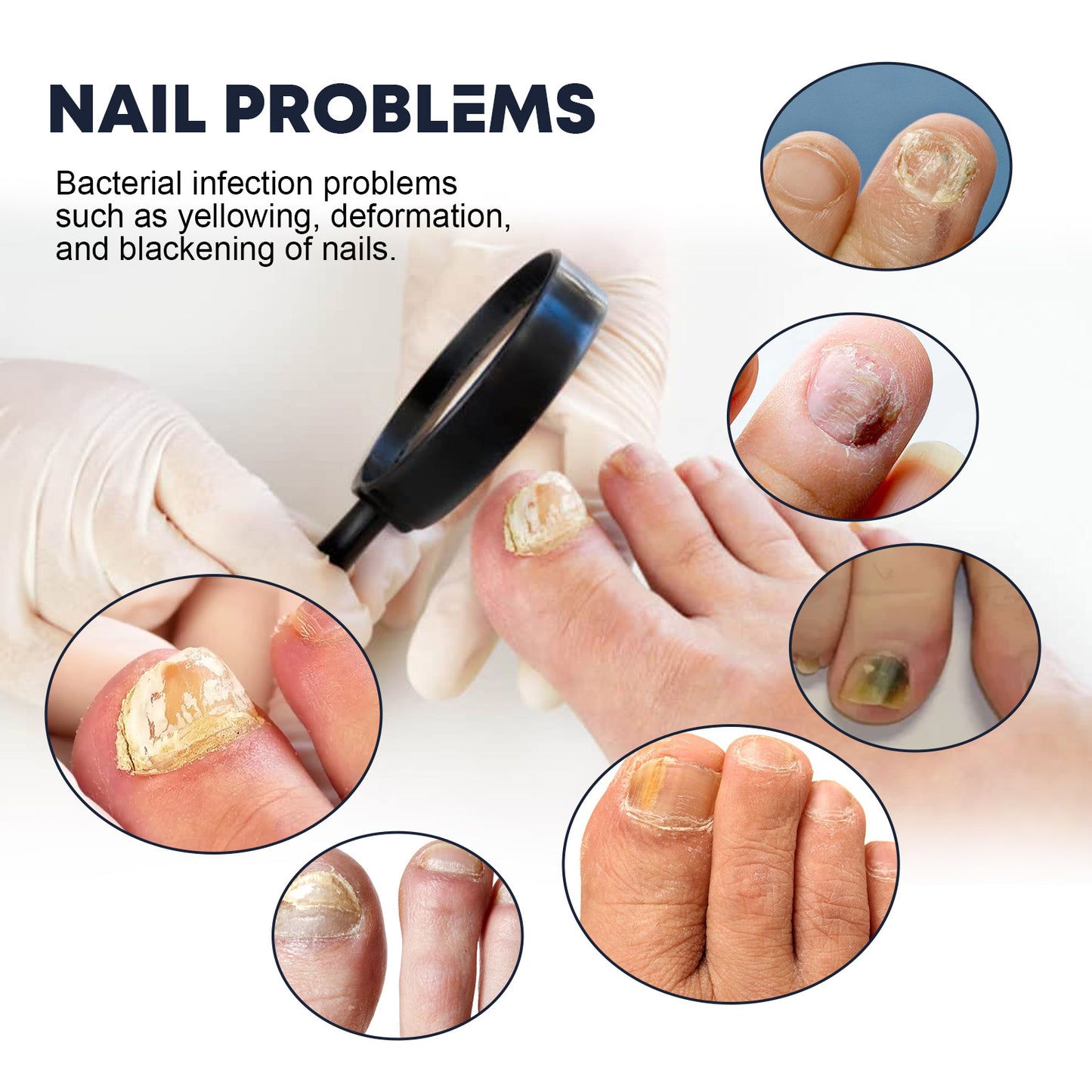 Nail Care Spray, To Reduce Brittle Nails By Layering Nail Strengthening Moisturizing Nutrient Solution