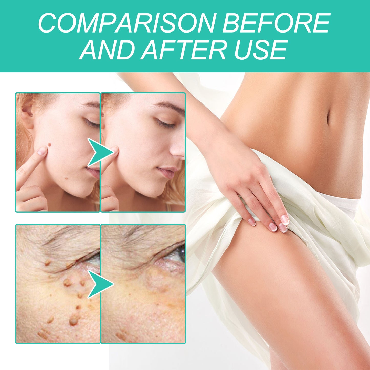 Keyu Liquid Repair Smooth Face Body Skin Deep Cleaning Moles Corns Keyu Liquid Pen