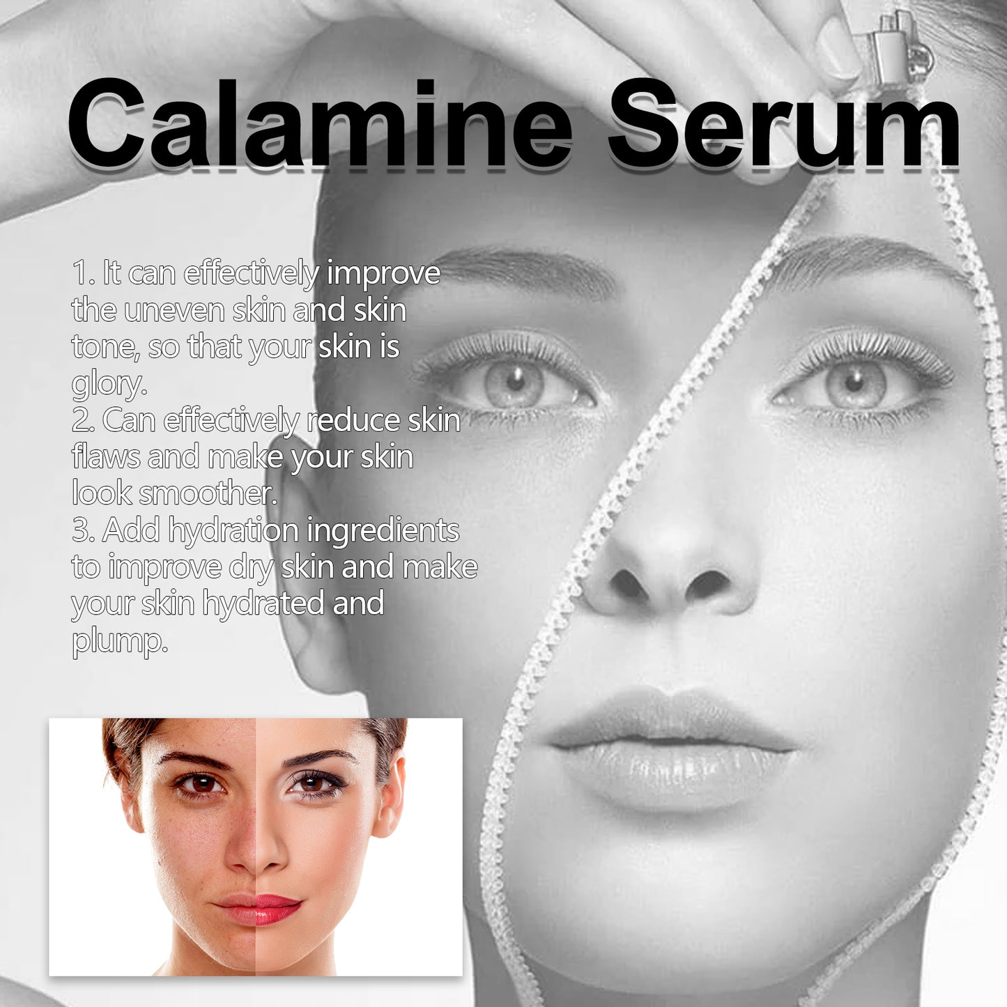 Calamine Serum, Improve Skin Dry Dull Acne Muscle Acne Hydrating Plump