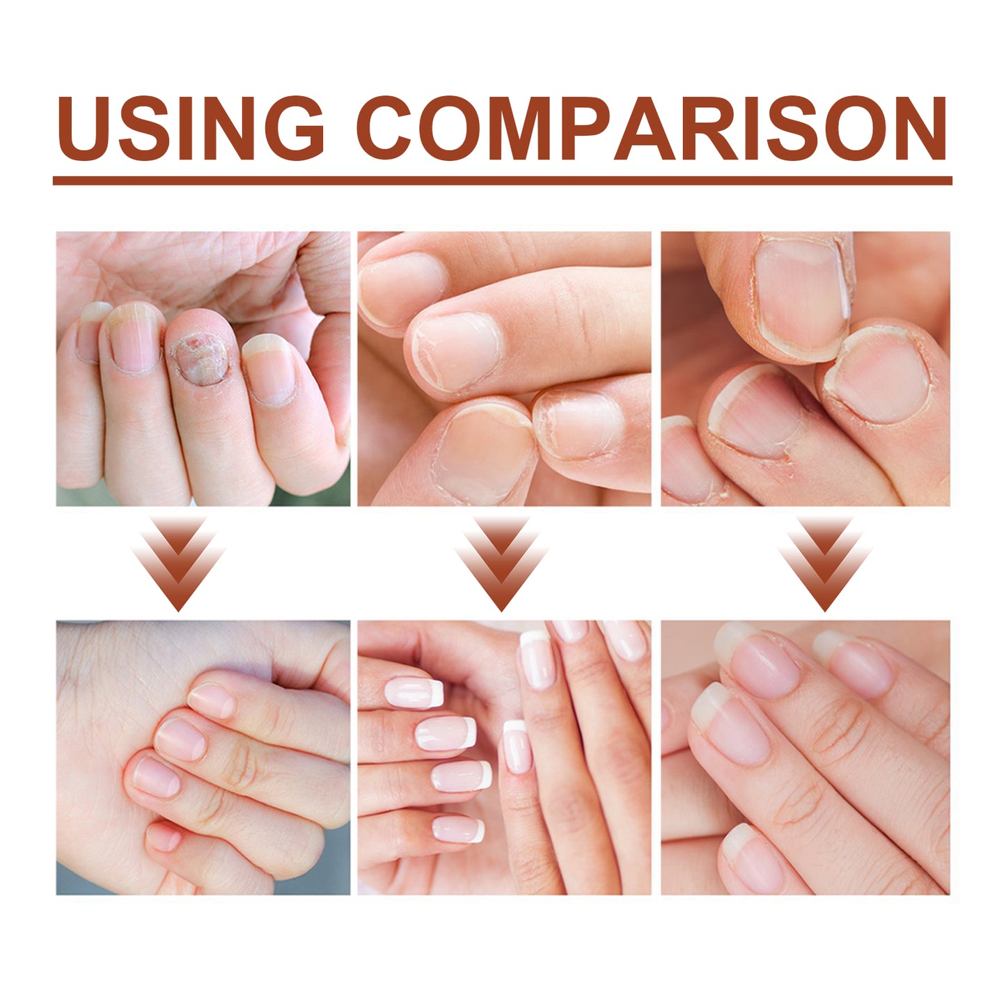 7 Day Nail Care Essence Grey Nail, Hand, Foot And Nail Nourishing Cleansing Essence