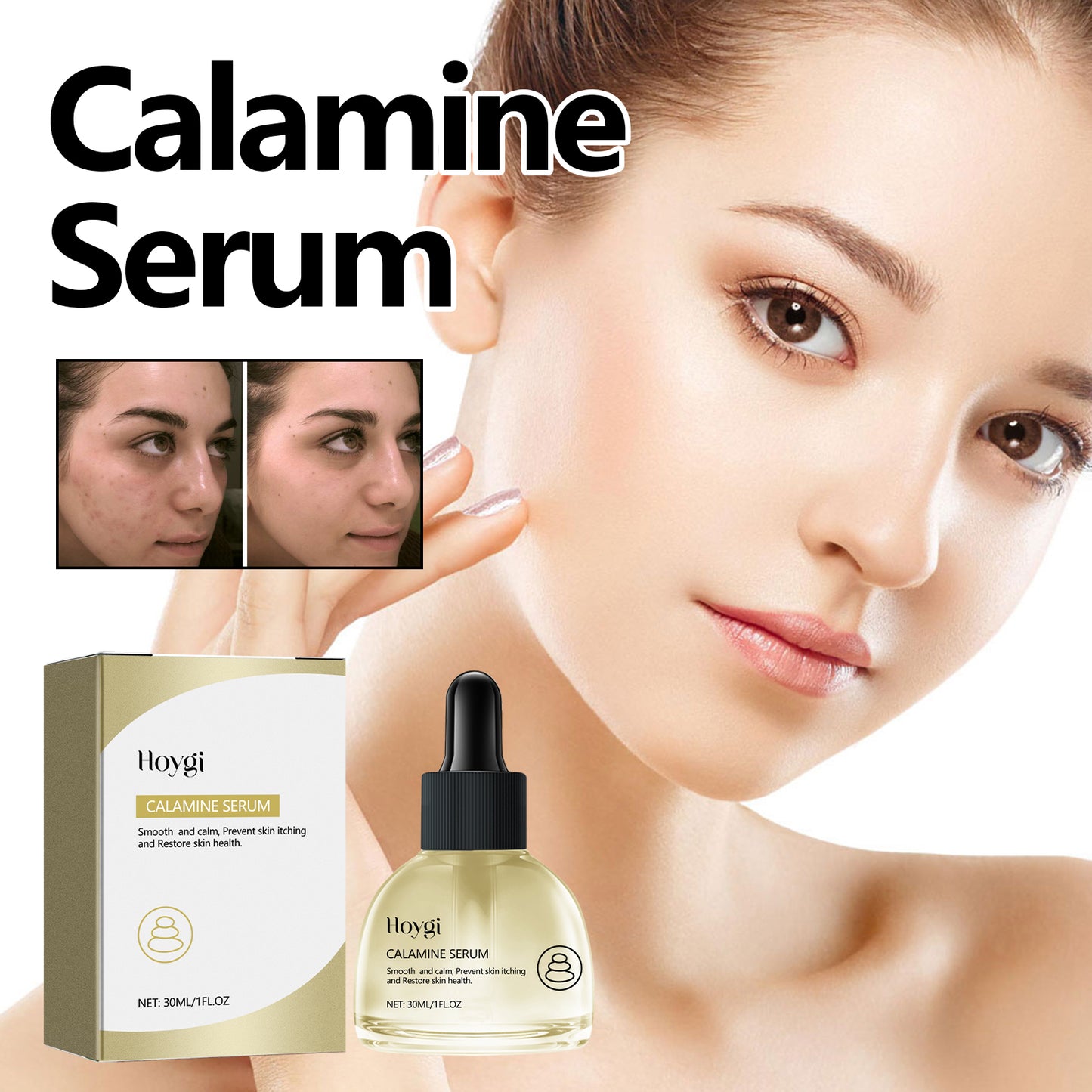 Calamine Serum, Improve Skin Dry Dull Acne Muscle Acne Hydrating Plump