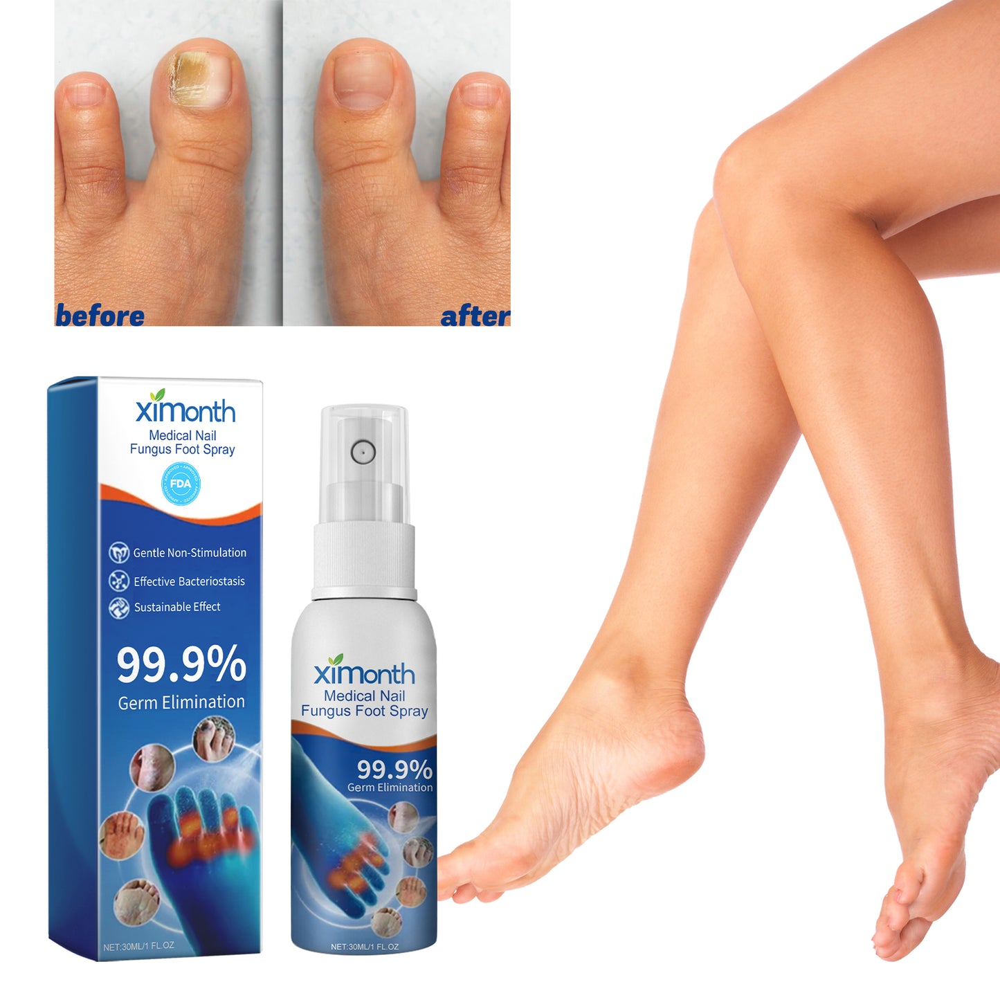 Medical Nail Fungus Foot Spray, Repair Thickening Gray Nail Rot Foot Moisturizing And Cleansing Armor