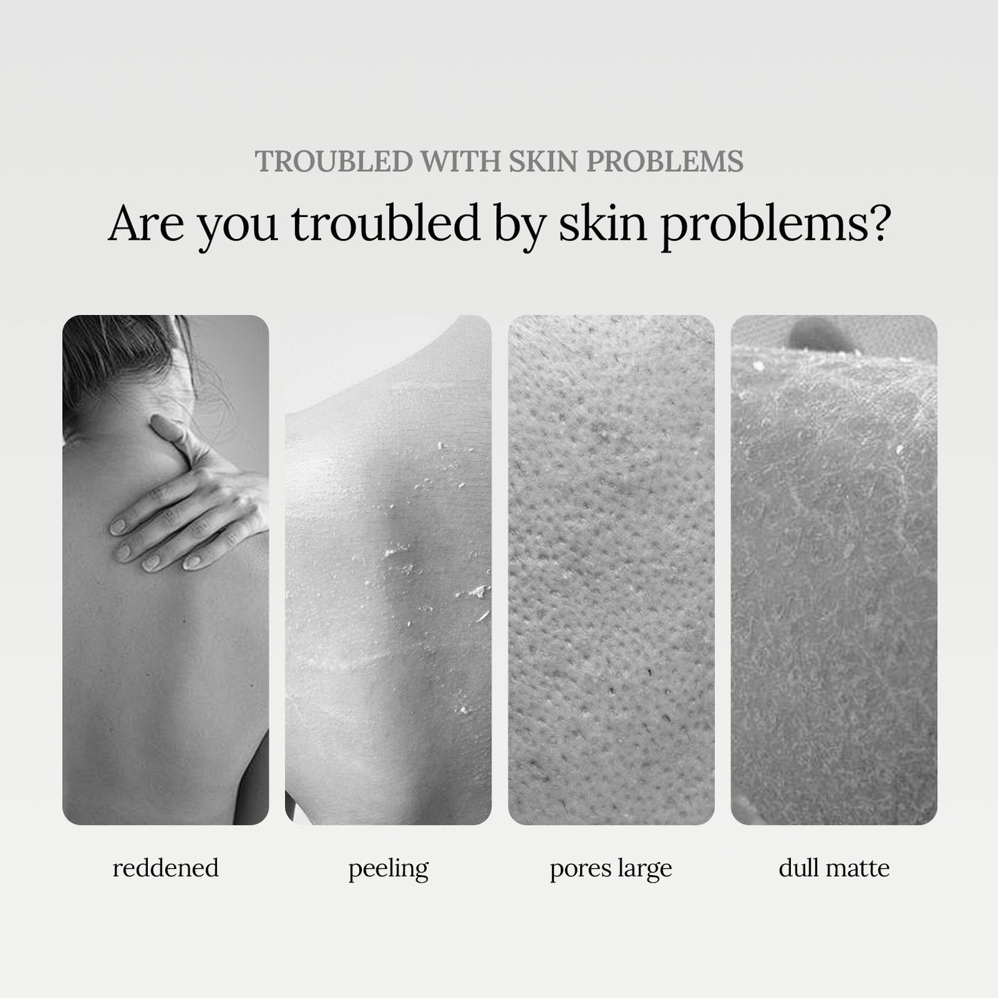 Niacinamide Scented Shower Gel, Body Cleans Corneous Brighten Skin Tone Delicate Pore Moisturize Repair