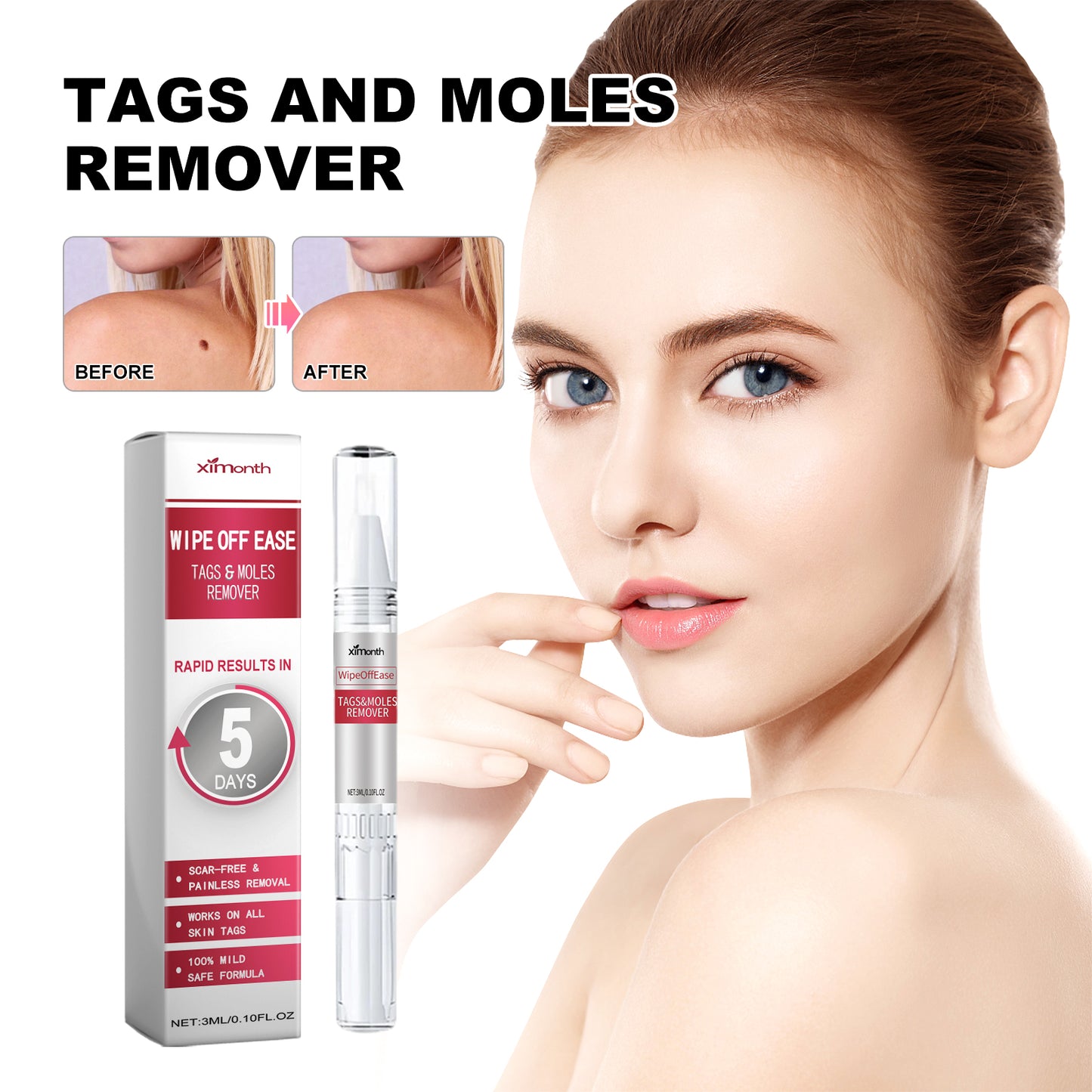 Skin Wart Lotion, Cleanses Skin And Removes Flat Eye Wart Lotion Especially Hand Cocoon