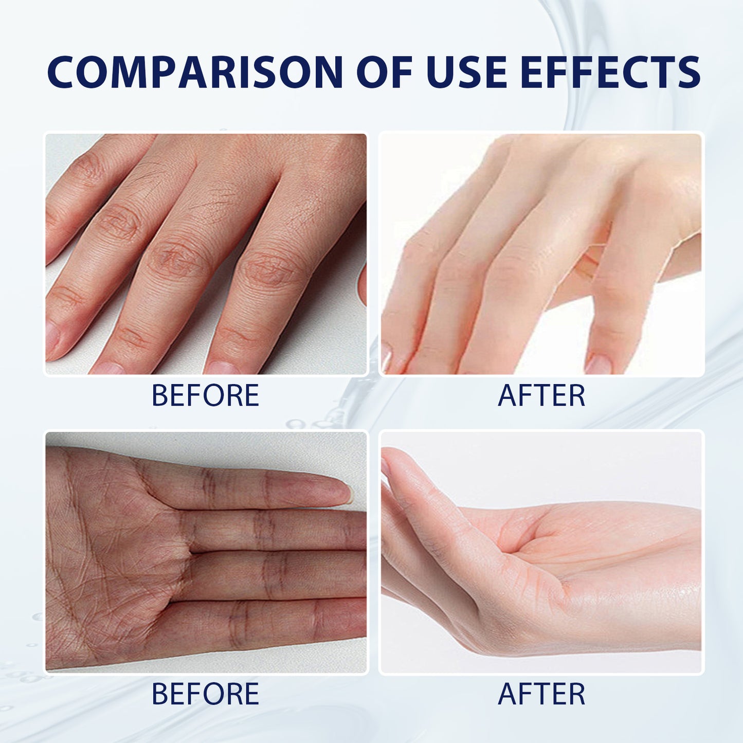 Aloe Vera Care Gel, Hydrating And Refreshing Moisturizing Cream Prevents Dryness And Cracks To Repair Hand Skin