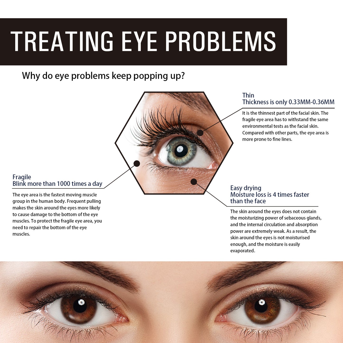 Retinol Eye Cream, Desalination Smoothen Fine Lines Eye Pouch Black Rim Of The Eye Moist Nursing Play Tight Muscle Eye Cream