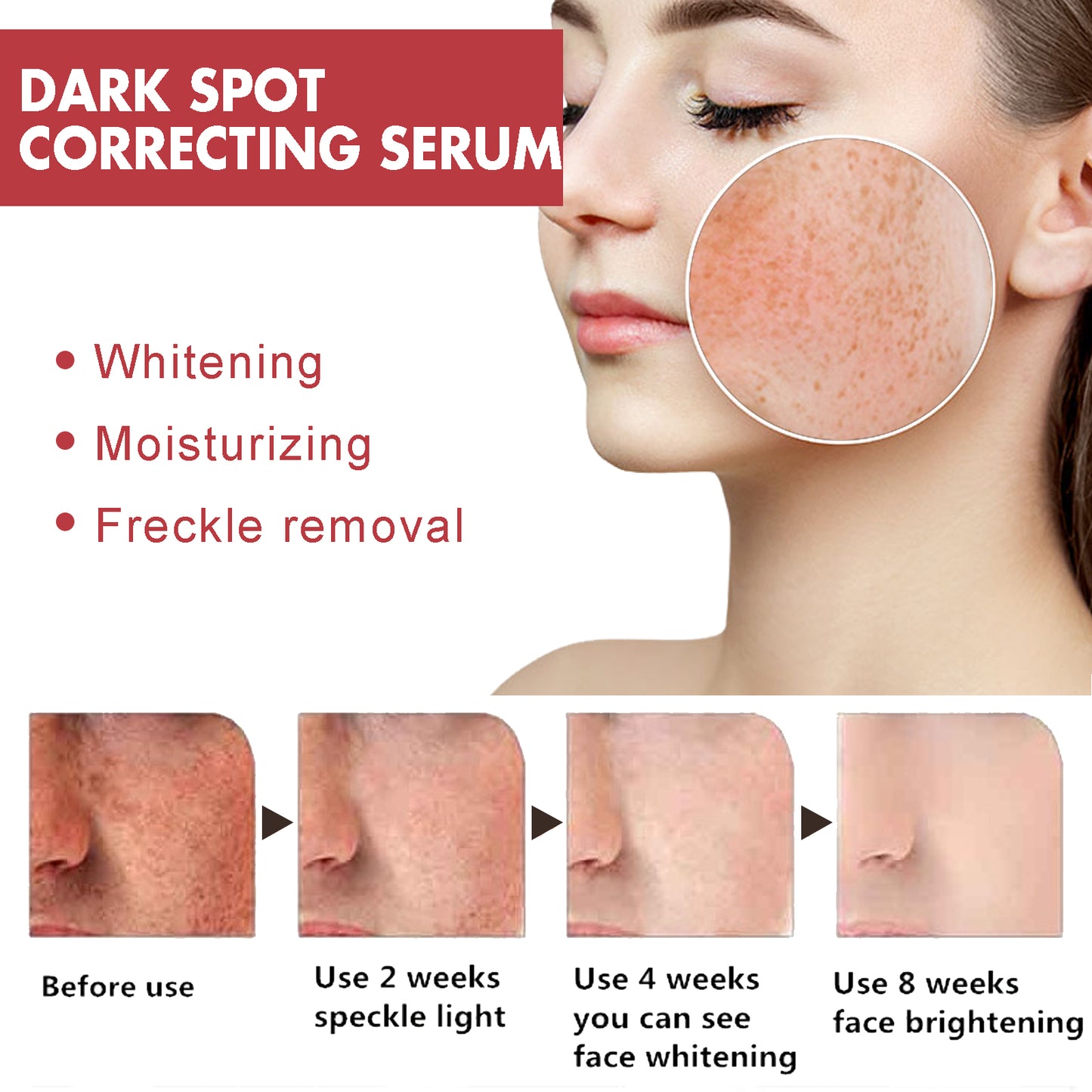 Dark Spots Repair Essence, Moisturizing And Brightening Repair Essence For Dark Spots And Age Spots