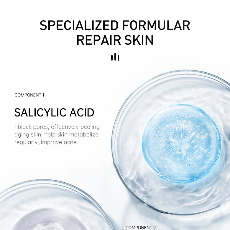 AUQUEST Acne Face Cream Salicylic Acid Oil Control Whitening Shrink Pores Beauty Health Korean Cosmetics Skin Care