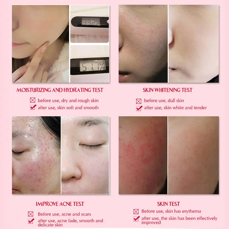 ARTISCARE Snail Essence 3pcs for Moisturizing and Nourishing Face Serum Skin Care Cream
