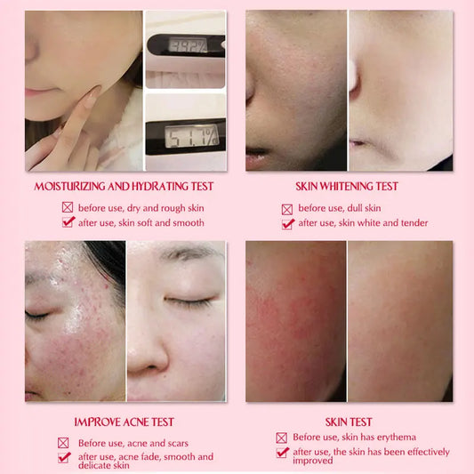 ARTISCARE Snail Essence 3pcs for Moisturizing and Nourishing Face Serum Skin Care Cream