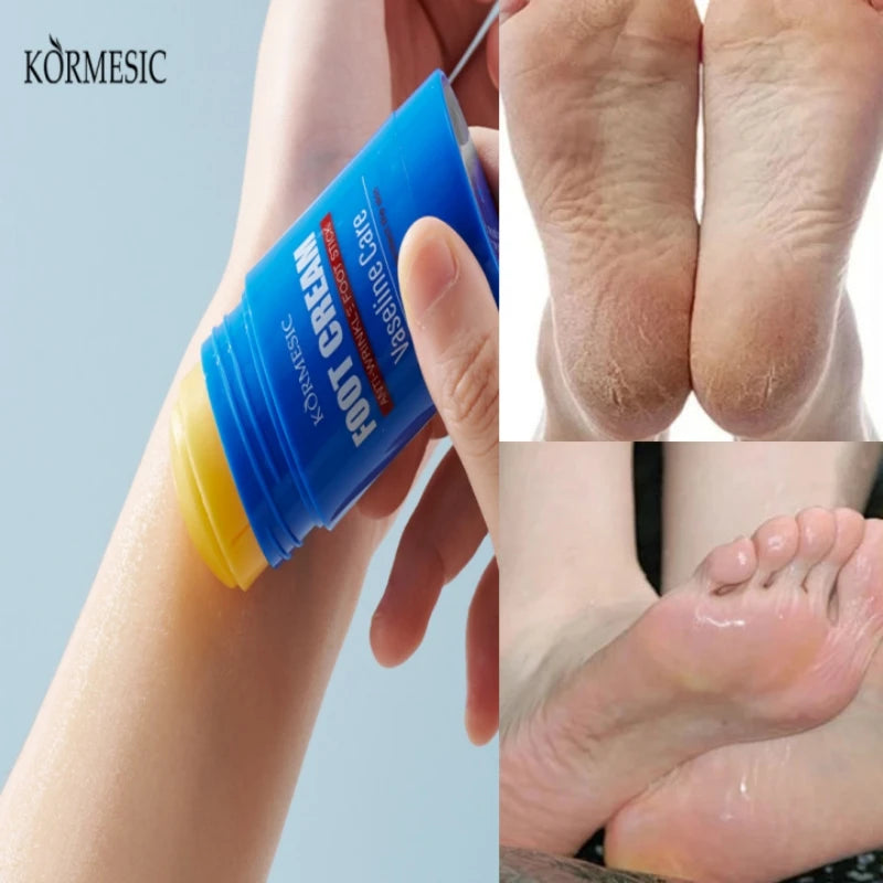 60% Urea Foot Cream Feet Heel Anti-Chapping Ultra-hydrating Softening Dry Cracked Product Gentle Exfoliation Daily Hand Foot Car