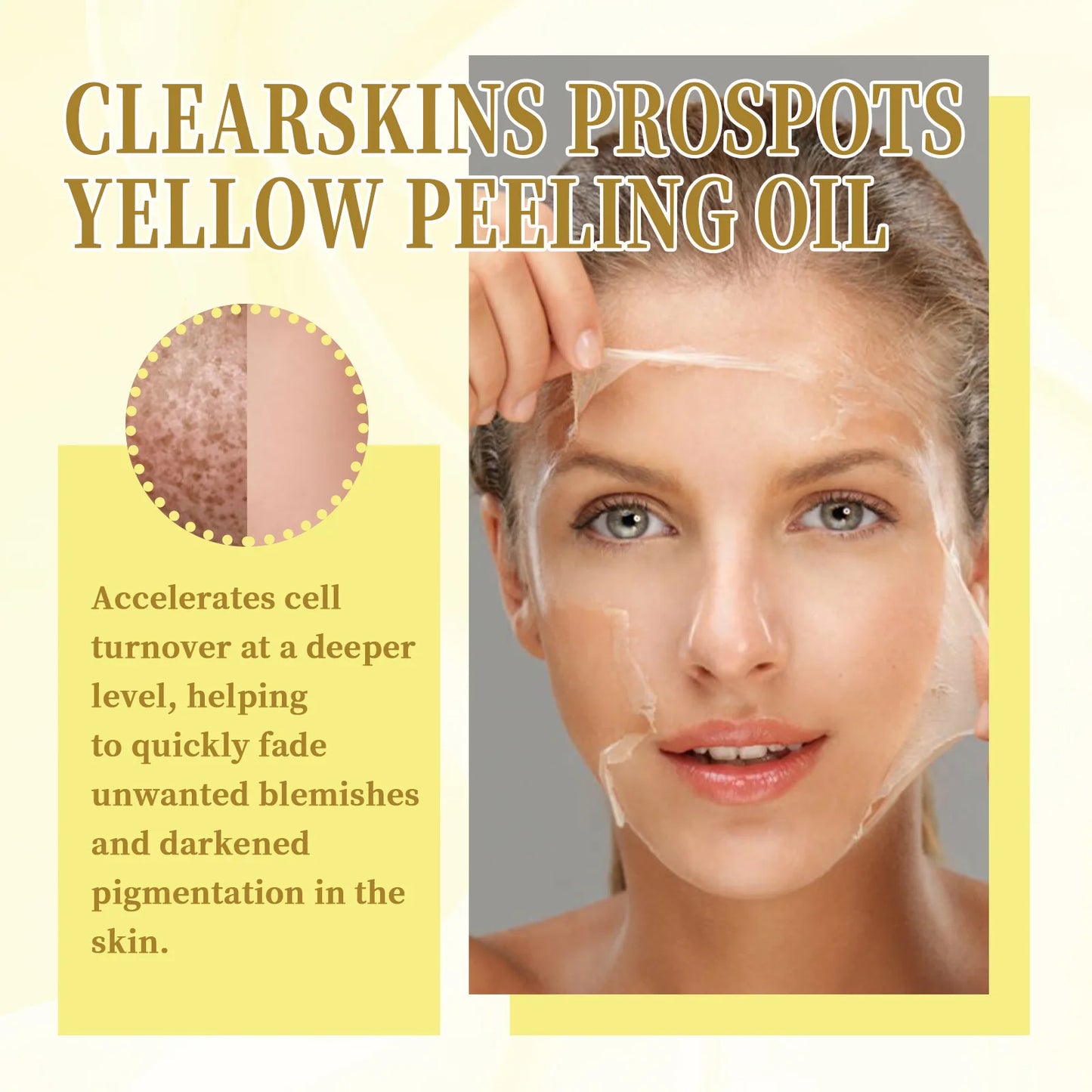 Yellow Peeling Oil Bleaching Brightening Dark Spots Body Knees Exfoliating Remove Dead Skin Lightening Melanin Whitening Serum