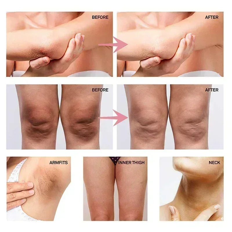 Body Moisturizing Underarm Whitening Cream Bleach Butt Knee Private Parts Melanin Brighten Lighten Dark Skin Care Women Beauty