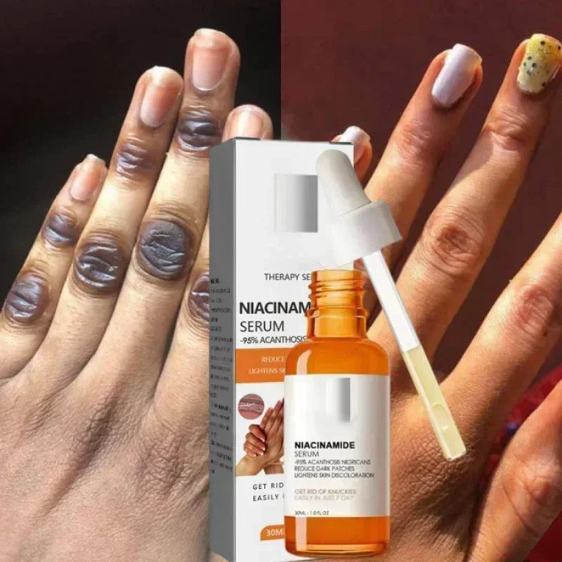 Dark knuckles whitening serum Elbows Armpit Beaching SerumWoman Private Part Skin Removal Dark Knuckles Strong Whitening Serum