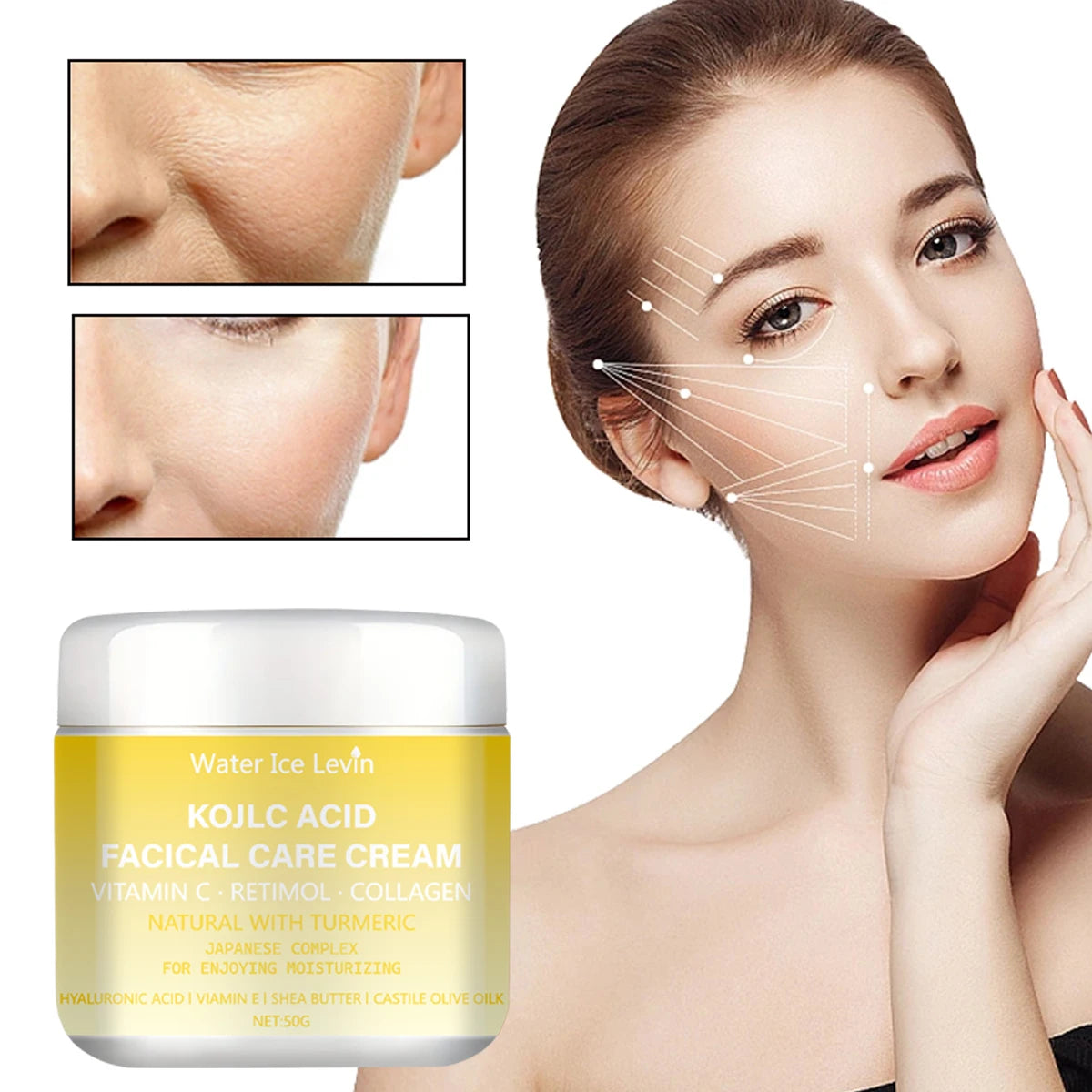 Winter Kollc Acid Brightening Cream - Vitamin C & Retinol Formula, Hydrates & Smooths Skin, With Shea Butter & Olive Oil