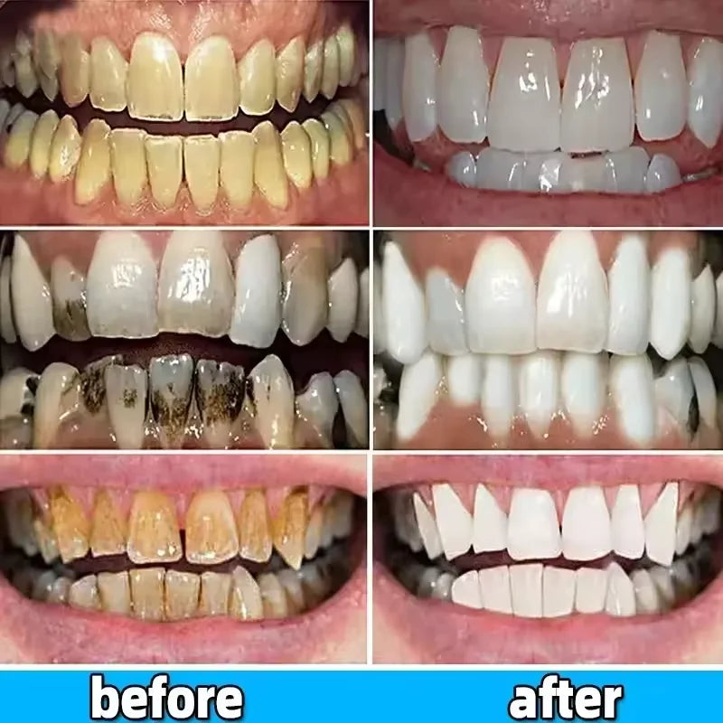 Teeth Whitening Toothpaste Serum Remove Plaque Stains Oral Hygiene Cleaning Dental Bleaching Tools Fresh Breath Tooth Care