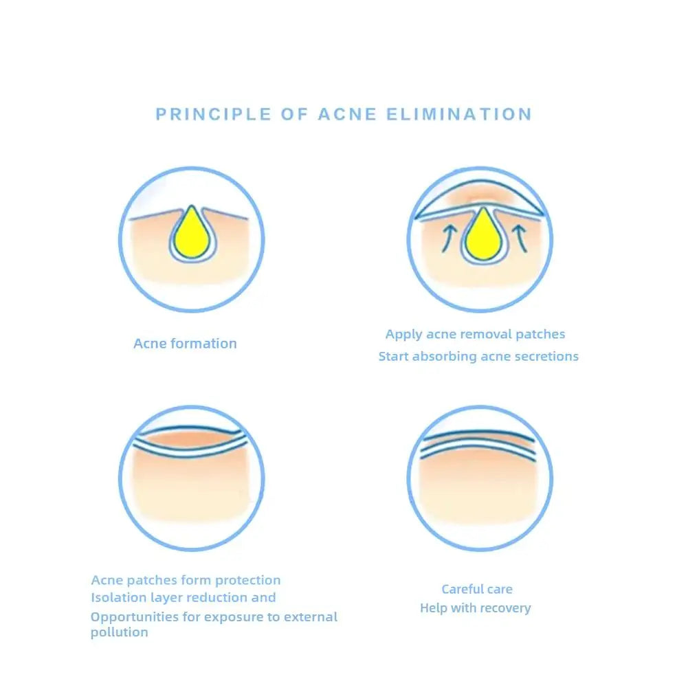 32patch Acne Pimple Patches Hydrocolloid Invisible Healing Absorbing Spot Sticker For Inflamed Acne Improve Whiteheads Skin Care