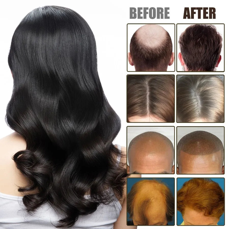 OUHOE NMN Scalp Cell Revitalizing Hair Essence Hair Care Strengthen And Strengthen Hair Repair Hair Root Thickening Hair Moistu