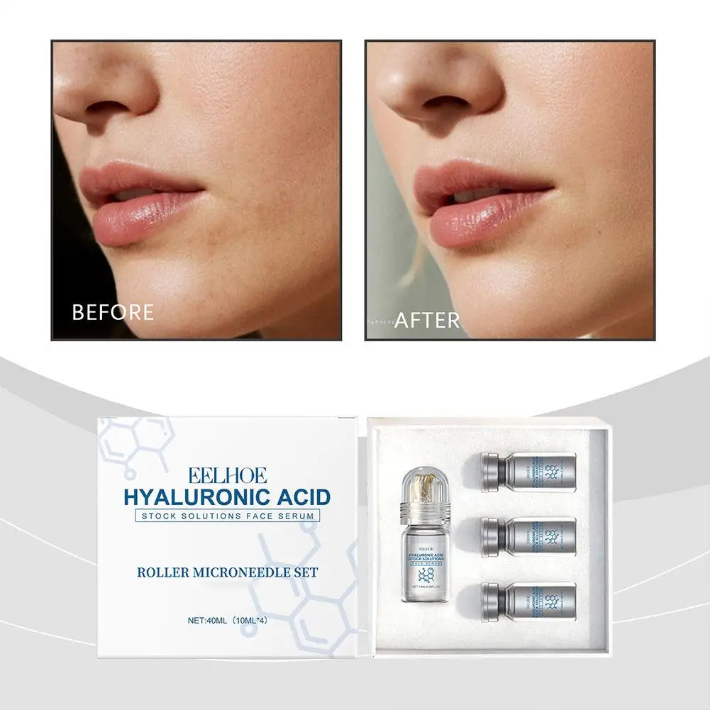 Hyaluronic Acid Stock Solutions Face Serum with Roller Microneedle Set Moisturizing Anti-Wrinkle Facial Serum Smoothing 0.25mm
