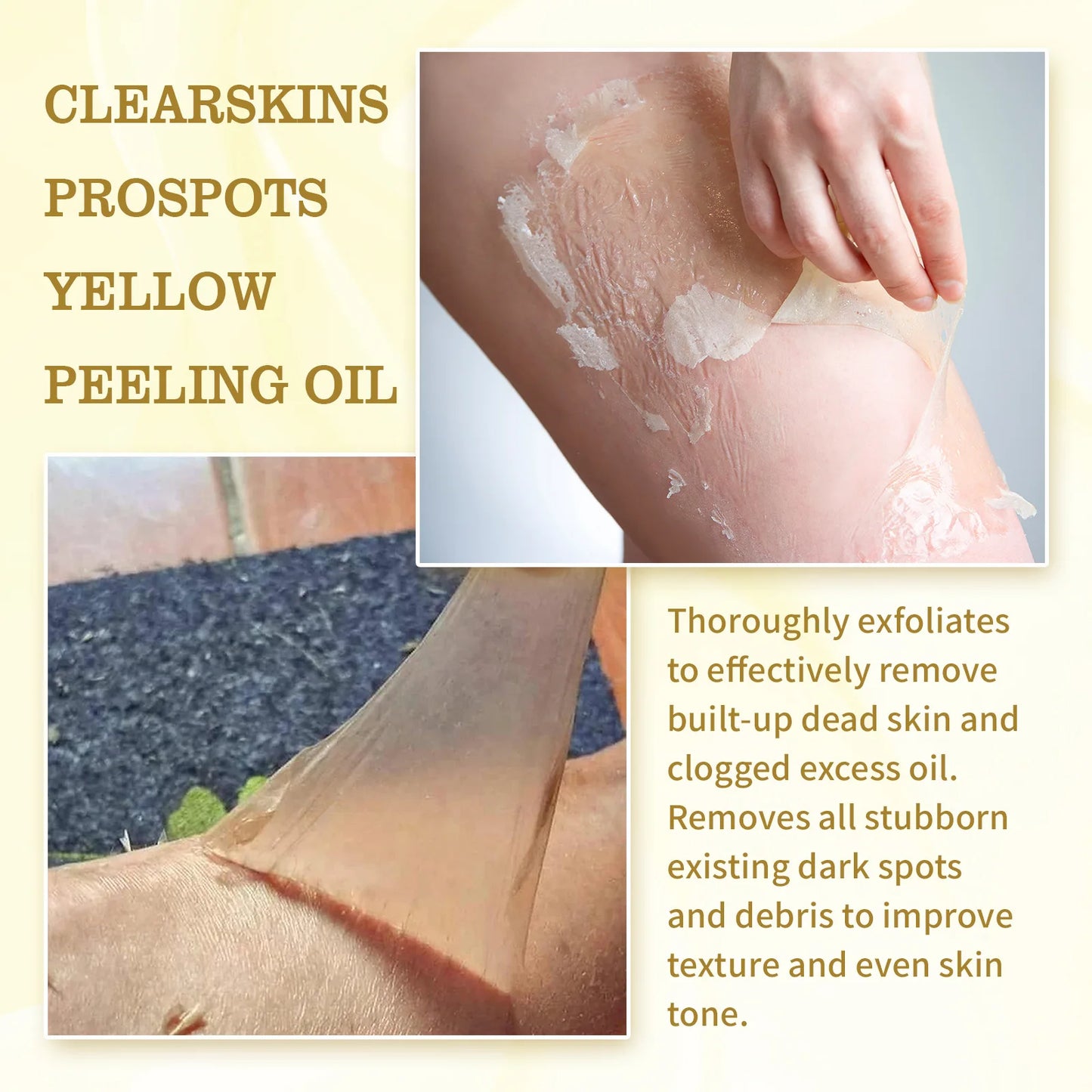 Yellow Peeling Oil Bleaching Brightening Dark Spots Body Knees Exfoliating Remove Dead Skin Lightening Melanin Whitening Serum