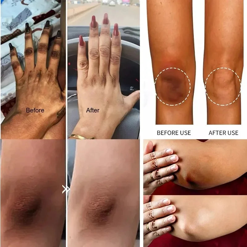 Body Moisturizing Underarm Whitening Cream Bleach Butt Knee Private Parts Melanin Brighten Lighten Dark Skin Care Women Beauty