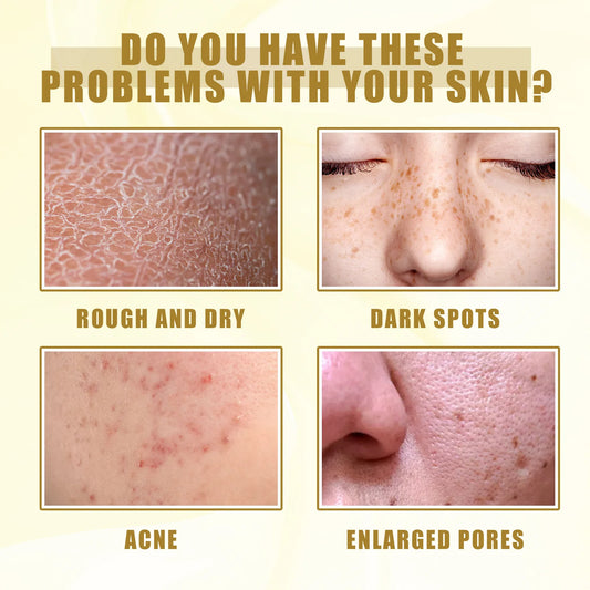 Yellow Peeling Oil Bleaching Brightening Dark Spots Body Knees Exfoliating Remove Dead Skin Lightening Melanin Whitening Serum