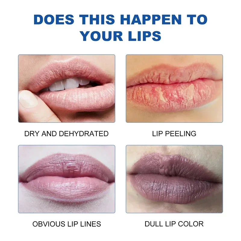 Remove Dark Lip Balm Lightening Melanin Mask Gloss Exfoliating Lip Pink Treatment Reduce Lip Lines Improve Dryness Moisturizing